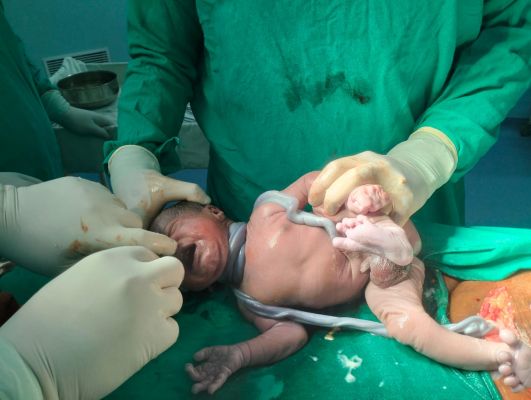 वनांचल लैलूंगा में सुरक्षित मातृत्व की नई मिसाल, शासन को नीति से सशक्त हो रही स्वास्थ्य सेवाएं,विशेषज्ञ सेवाओं से बढ़ा संस्थागत प्रसव, 574 सुरक्षित डिलीवरी कर रचा इतिहास